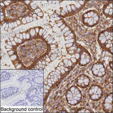 Валидация AntibodySystem RHF70301