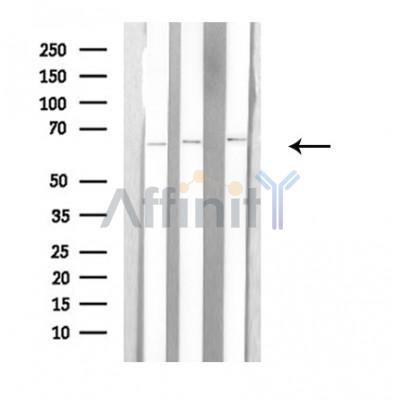 Валидация Affinity DF3795 - 14907