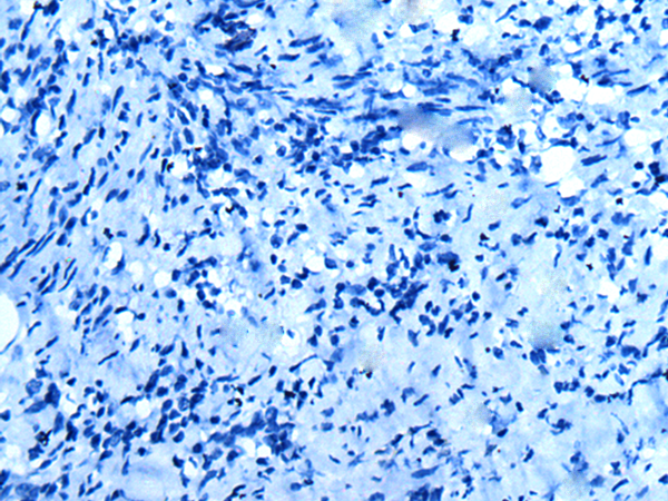 Валидация AssayVector ARM1657(1820)