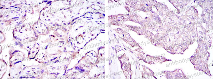 Валидация AntibodySystem RVV08907