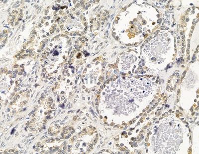 Валидация Affinity DF14854 - 10990