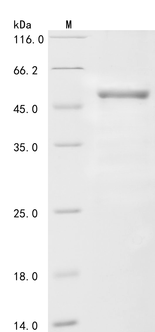 SDS-PAGE