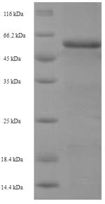 SDS-PAGE