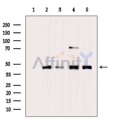 Валидация Affinity DF9418 - 21971