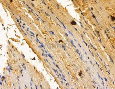 Валидация Affinity DF14994 - 11197