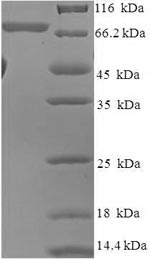 SDS-PAGE