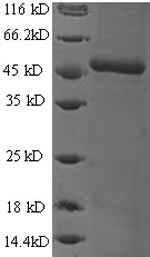 SDS-PAGE