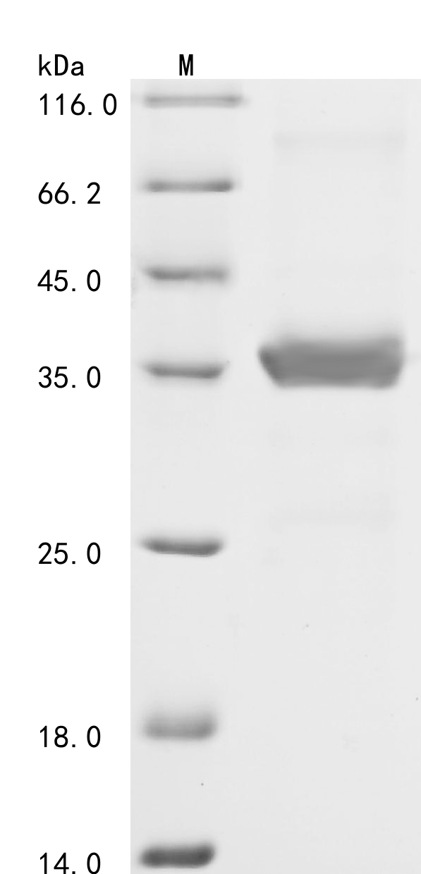 SDS-PAGE