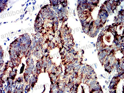 Валидация AntibodySystem RHF04003 (2432)