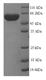 SDS-PAGE