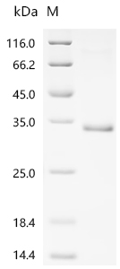 SDS-PAGE