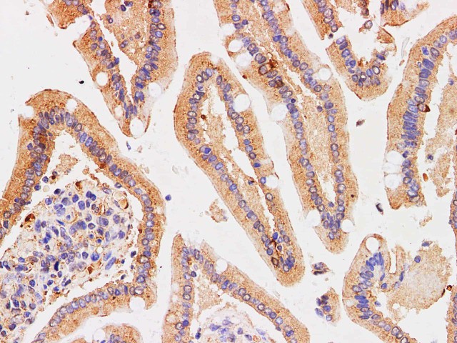 Иммуногистохимия, Chromogranin A, ткань двенадцатиперстной кишки человека