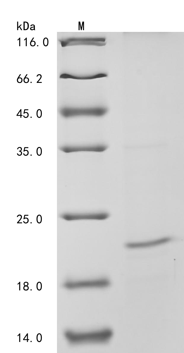 SDS-PAGE