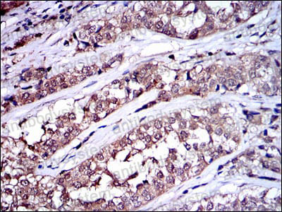 Валидация AntibodySystem RHC95705 (1210)