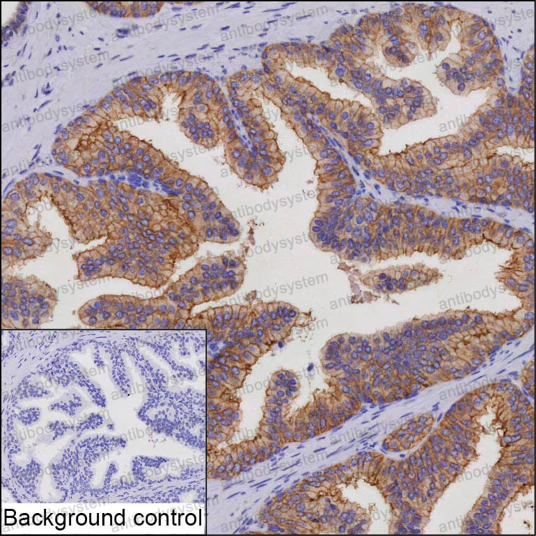 Валидация AntibodySystem RHJ76001
