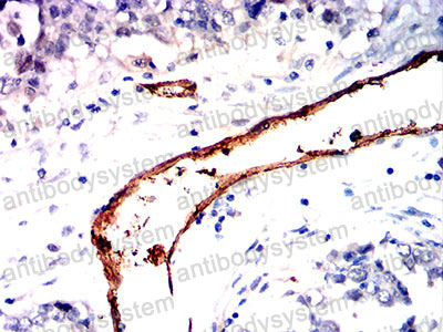Валидация AntibodySystem RHD26504