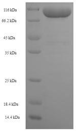 SDS-PAGE
