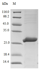 SDS-PAGE