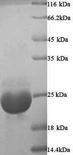 SDS-PAGE