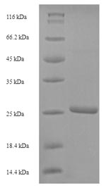 SDS-PAGE