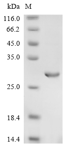 SDS-PAGE