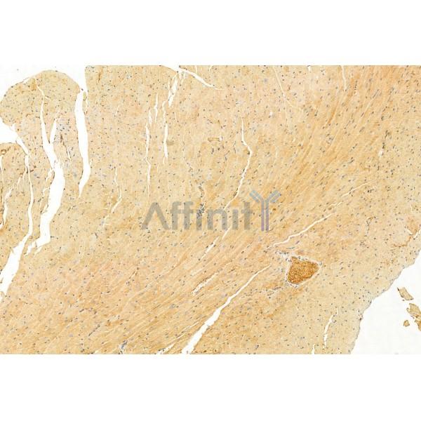 Валидация Affinity DF12032 - 6062