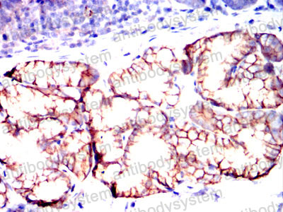 Валидация AntibodySystem RHD74903