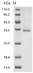SDS-PAGE