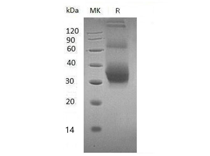 Валидация Elabscience PKSM041116(5033)