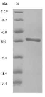 SDS-PAGE