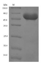 SDS-PAGE