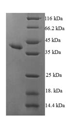 SDS-PAGE
