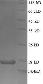 SDS-PAGE