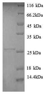 SDS-PAGE
