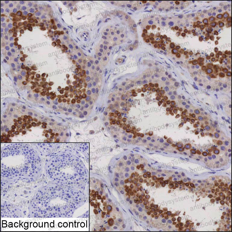 Валидация AntibodySystem RHP11101