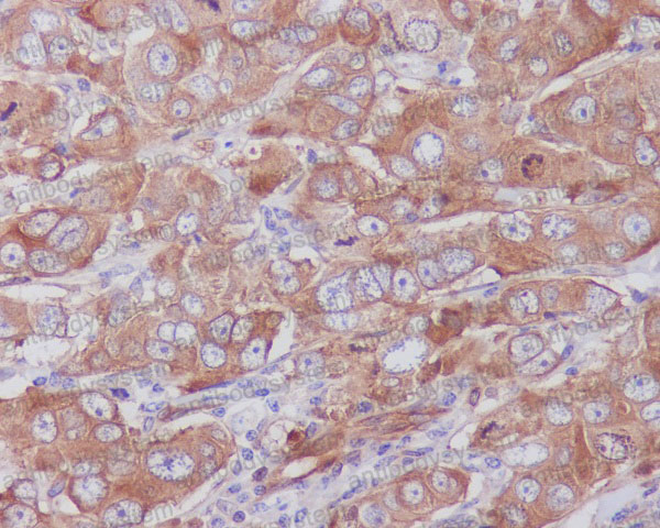 Валидация AntibodySystem RHE62401