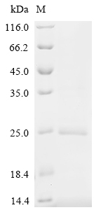 SDS-PAGE