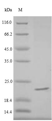 SDS-PAGE