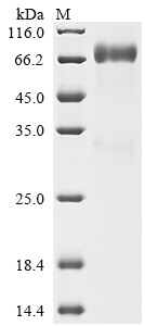 SDS-PAGE