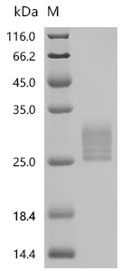 SDS-PAGE