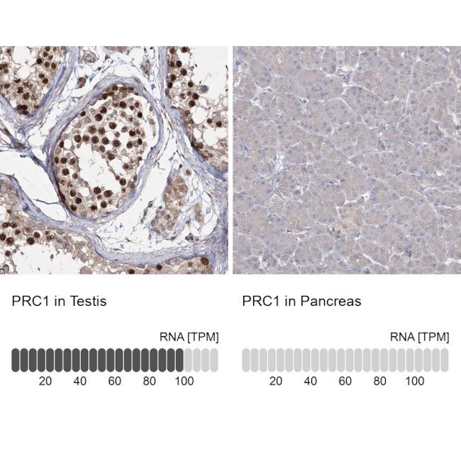 Валидация AssayVector ARM2701(5145)