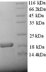 SDS-PAGE