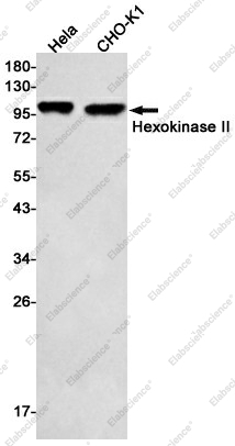 Вестерн-блоттинг, Hexokinase II, клетки HeLa и CHO-K1