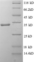 SDS-PAGE