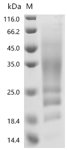 SDS-PAGE