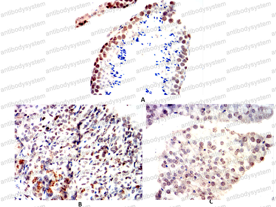 Валидация AntibodySystem RHC91302 (1173)