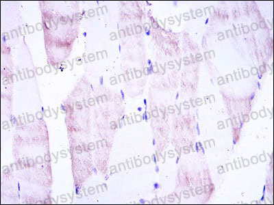 Валидация AntibodySystem RHG57001