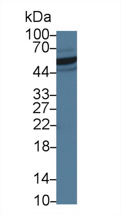 14323