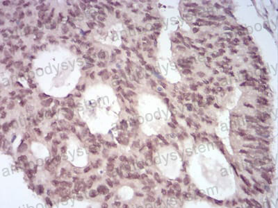 Валидация AntibodySystem RHD17903