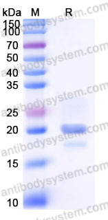 AHJ51102, SDS-PAGE